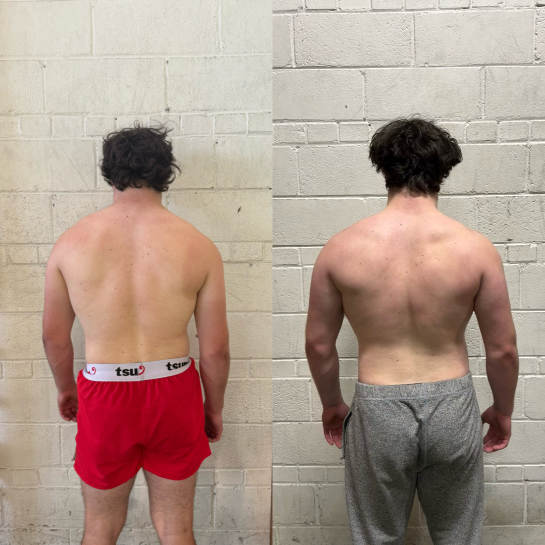 Hudson, age 17 — back view before and after 5-month SMPerformance transformation