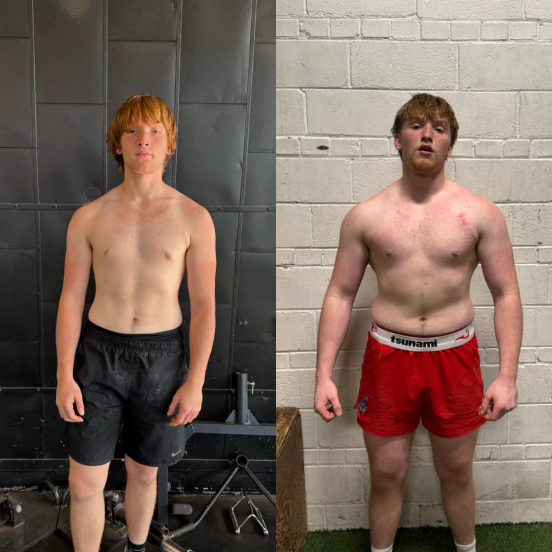 Matthew, age 17 — front view before and after 12-month SMPerformance transformation